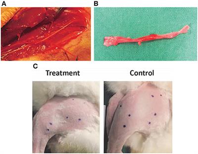 Cord Lining Mesenchymal Stem Cells Have a Modest Positive Effect on Angiogenesis in Hindlimb Ischemia